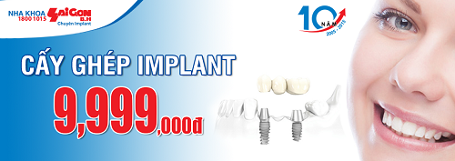 Trồng răng implant với giá cực kỳ ưu đãi 9,999,000đ